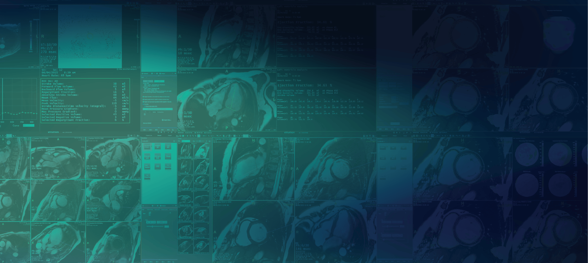 Schedule A Meeting At 2025 UKIO Congress TeraRecon schedule-a-meeting-at-2025-ukio-congress-terarecon